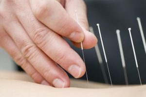 Dr. Langevin on Vermont Public Radio: Can Opiod Use be Avoided by Treating Pain with Acupuncture?