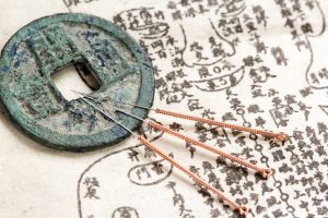 First Time Acupuncture Treatment: What to Expect